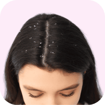 Dandruff Medicines