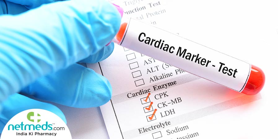 Cardiac Marker Test