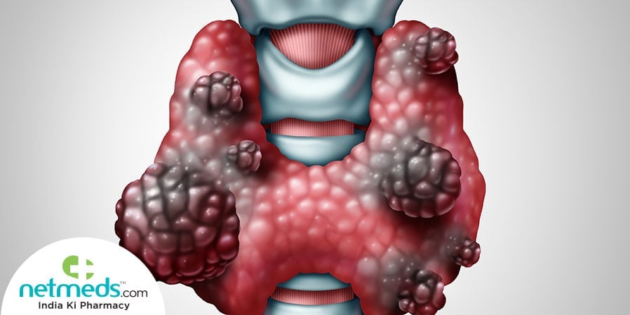 Hurthle cell cancer treatment