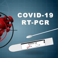 The RT-PCR Test: How This Assay Detects COVID-19 And Other Details Explained
