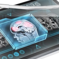 Functional Magnetic Resonance Imaging (fMRI): What Is It and What To Expect?