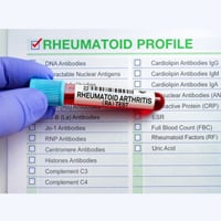 RF Factor Test: Why It Is Done? Purpose, Procedure And Results