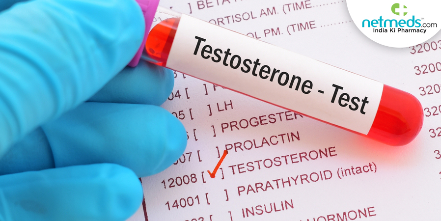 Testosterone test
