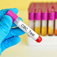 Complete Blood Count: What Is It And What To Expect?