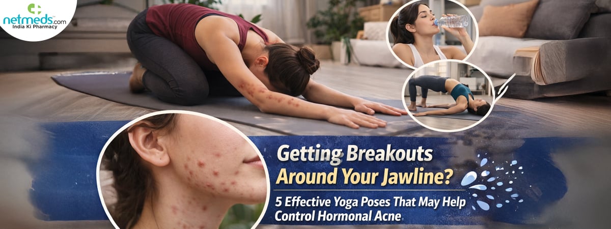 hormonal-acne_1200x450