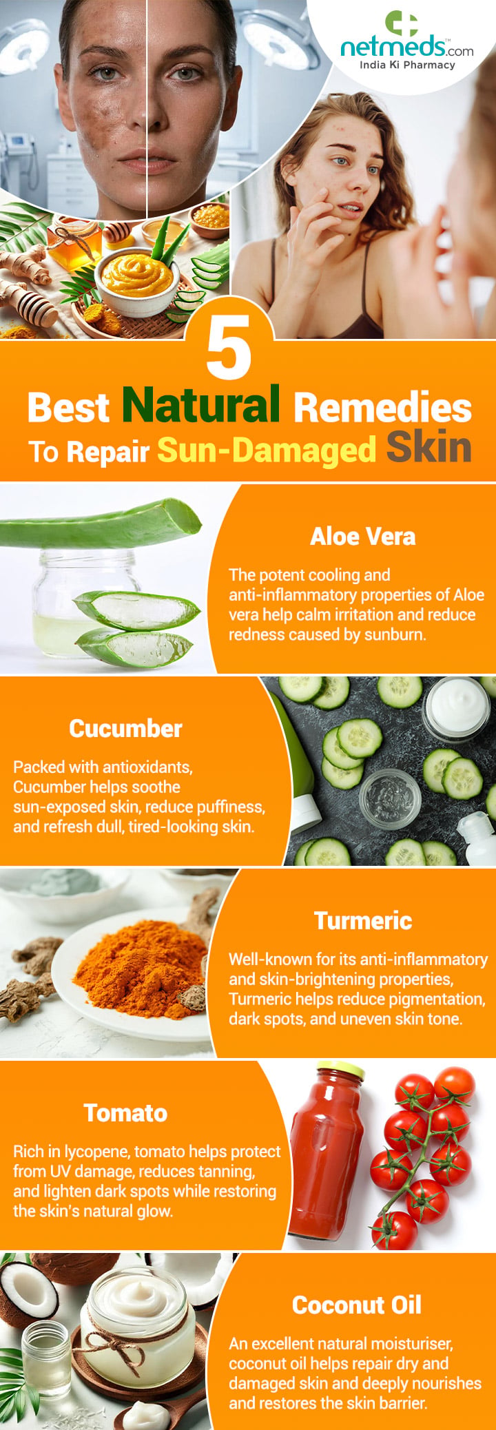 5-Best-Natural-Remedies-To-Repair-Sun-Damaged-Skin