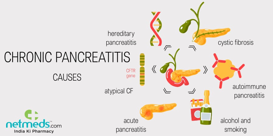 Autoimmune Pancreatitis