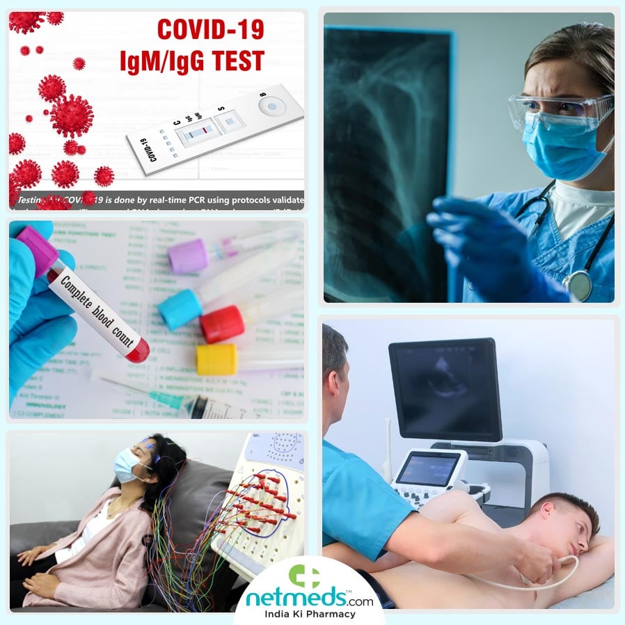 COVID-19 Tests