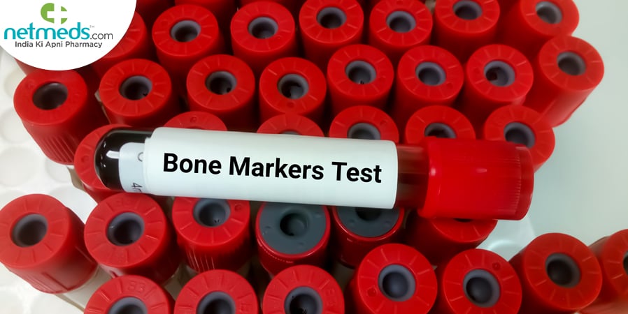 Bone Markers Test