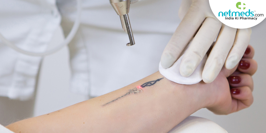 Getting Tattoo