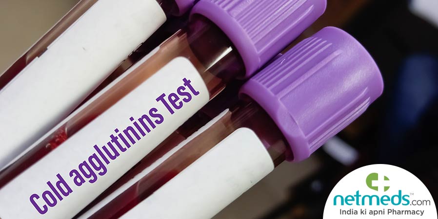 Cold Agglutinins Test