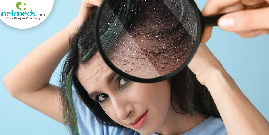 dandruff