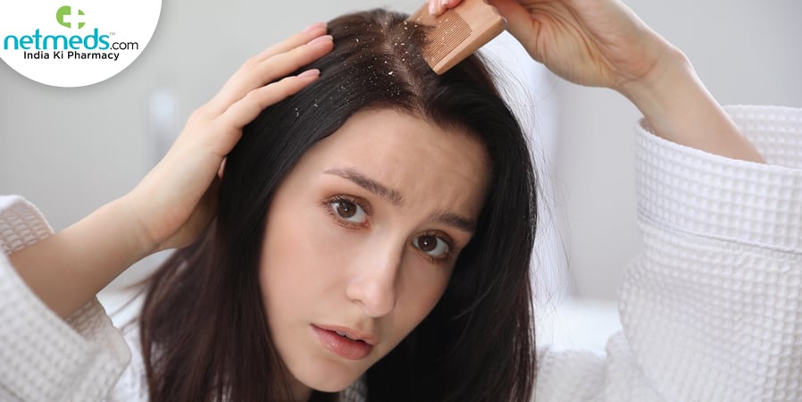 dandruff