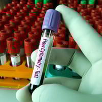 Flow Cytometry Test: What Is It? Why Is The Test Done? Components And The Benefits Of This Test