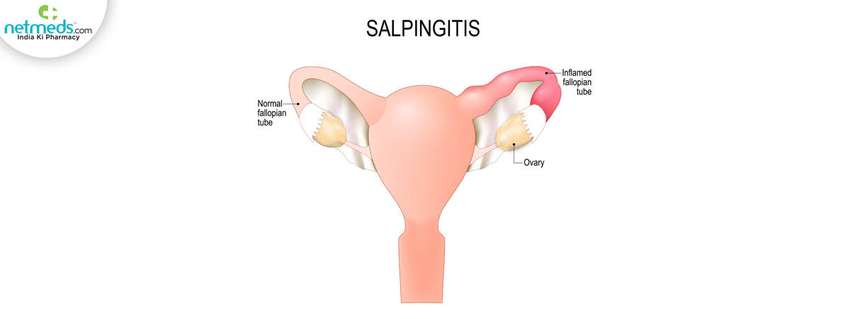 salpingitis causes