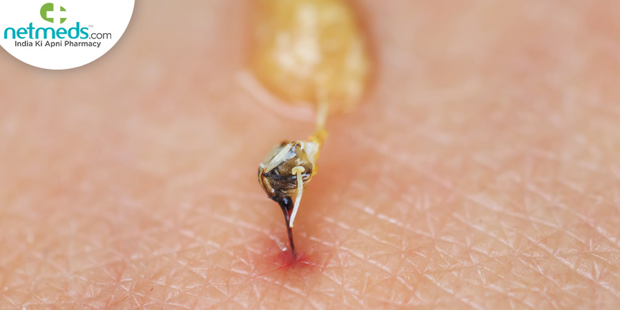 Insect biting