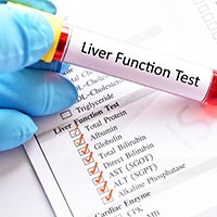 Liver Function Tests: Know The Types, How It Is Done And What To Expect