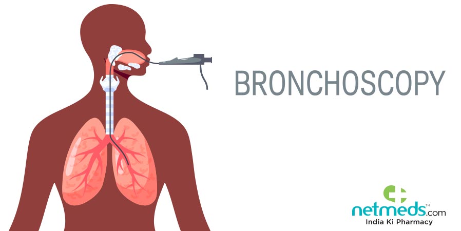 Bronchoscopy