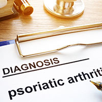 Psoriatic Arthritis: Causes, Symptoms And Treatment