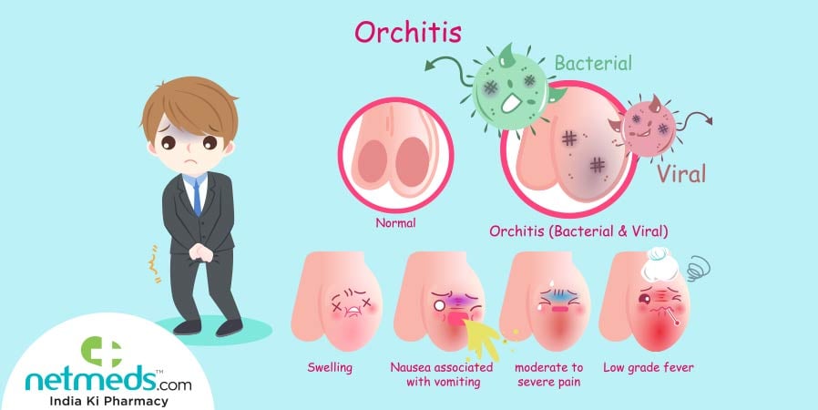 orchitis causes and symptoms
