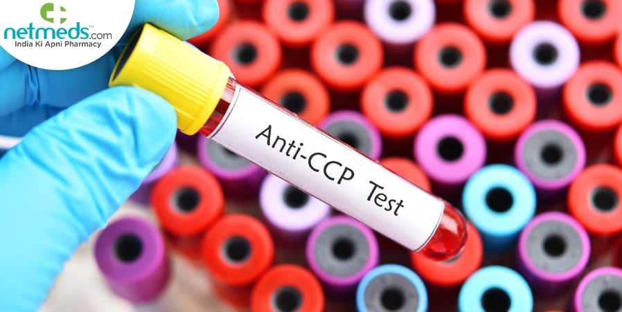 Anti-CCP Test