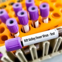 Valley Fever Testing/Coccidioides Precipitin: Why Is It Done And What Do The Test Results Mean?