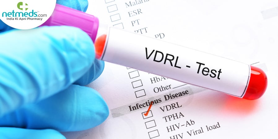 VDRL Test