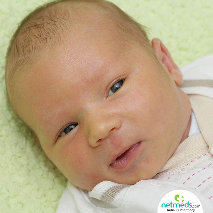 New-born Jaundice
