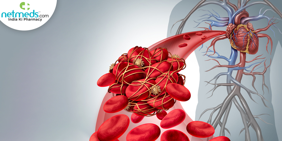 Blood clots