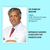 Metabolic Surgery, A New Hope For Diabetes Cure
