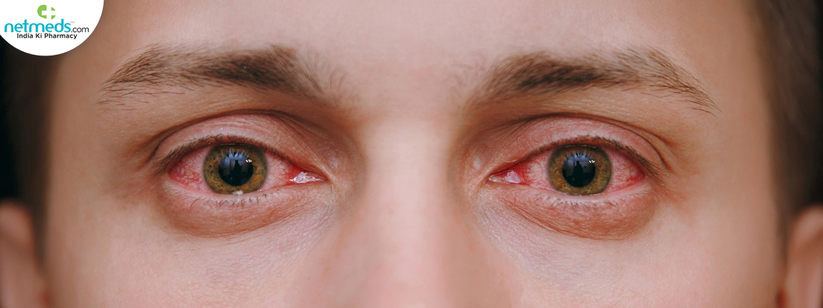 Eye-infection_1200x450