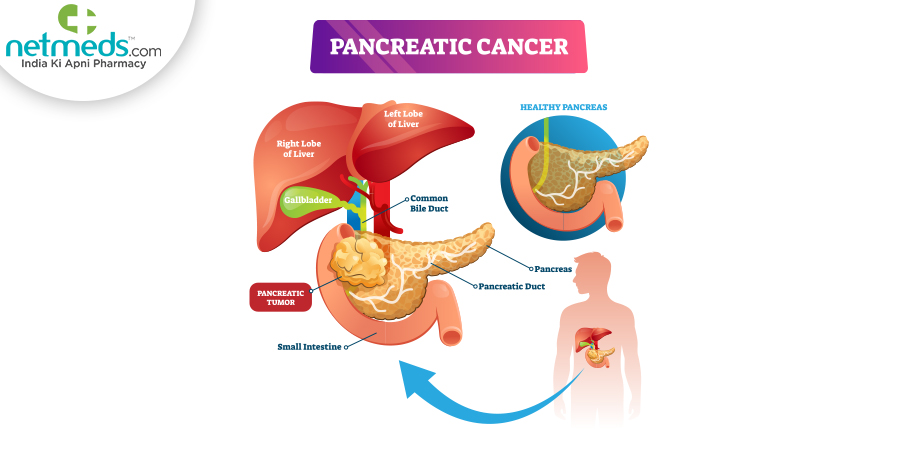 Pancreatic Cancer