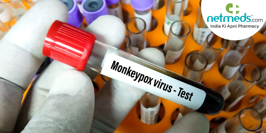 Monkeypox virus - Test