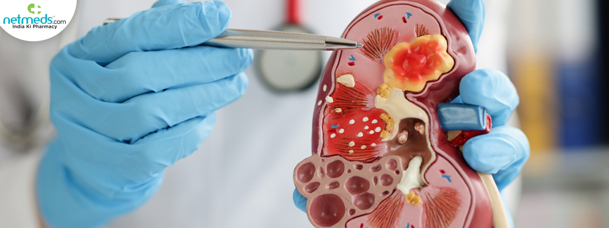 renal sarcoma