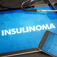 Insulinoma: Causes, Symptoms And Treatment