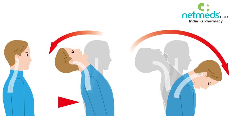 Whiplash illustration