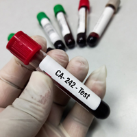 CA 242 Tumour Marker Test: What Is It? Purpose, Procedure and Results