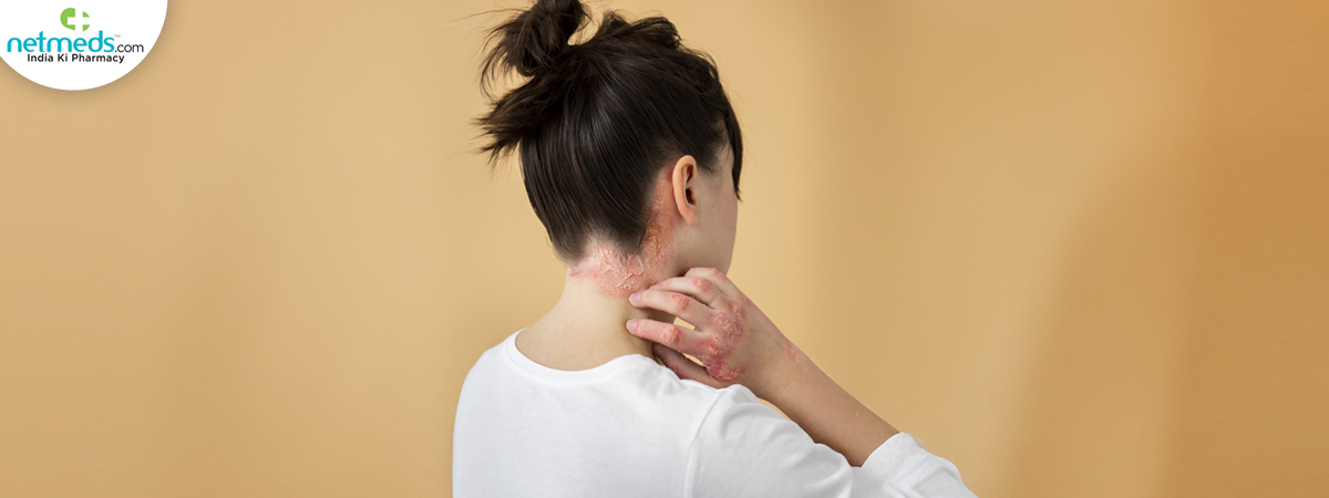 psoriasis-eczema_1200x450