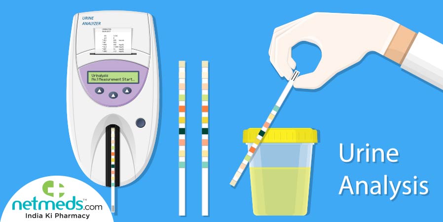 Urinalysis
