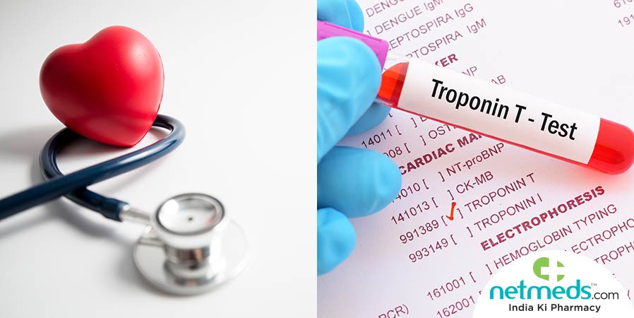 Troponin Test