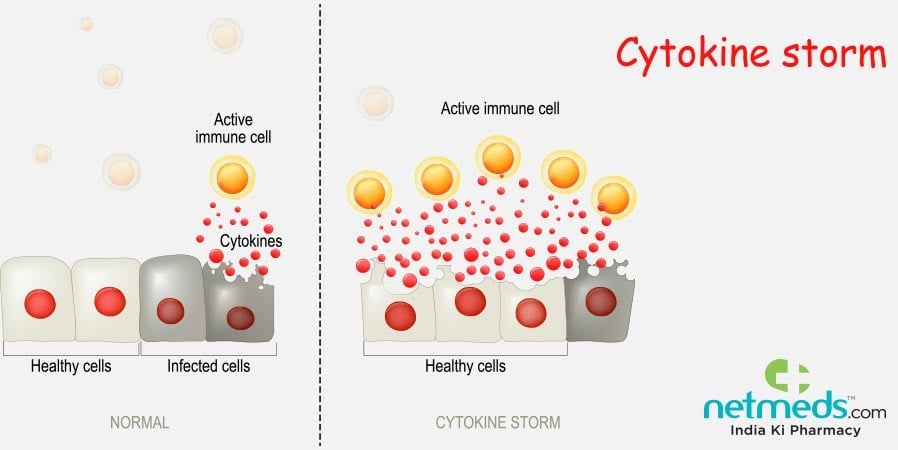 Cytokine storm