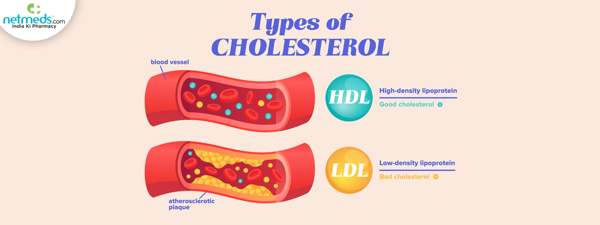 Cholesterol good or bad