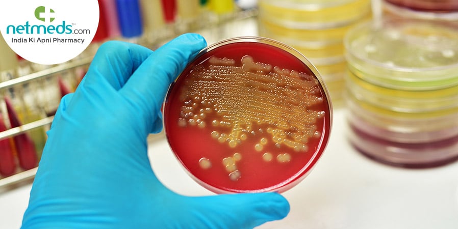 Stool culture
