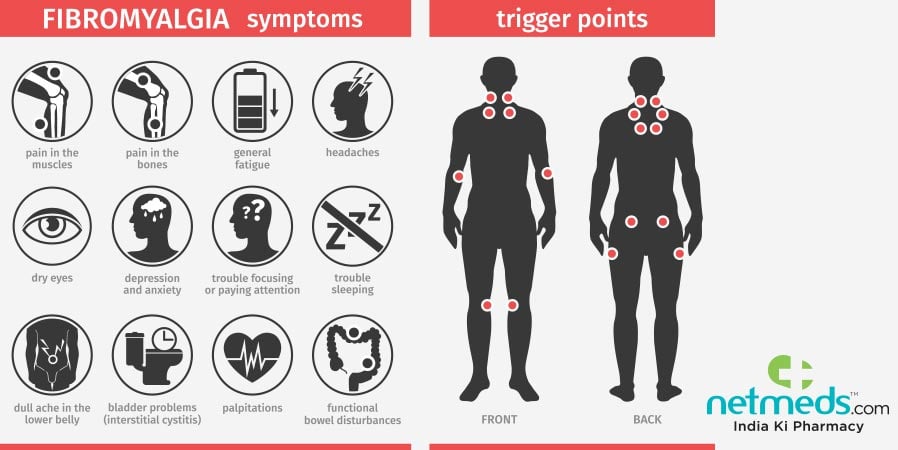 Fibromyalgia symptoms and trigger points