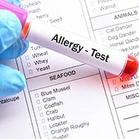 Allergy Testing: What Is It And What To Expect?