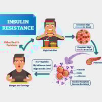 Insulin Resistance: Symptoms, Risk Factors, Diagnosis And Prevention