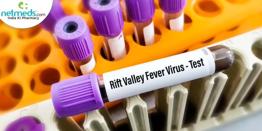 Valley Fever testing