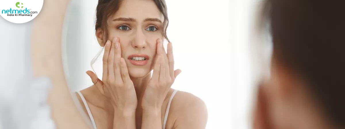 stress-induced-skin-main_1200x450