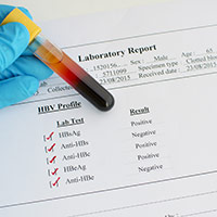 Fever Profile Test: What It Is And What To Expect?
