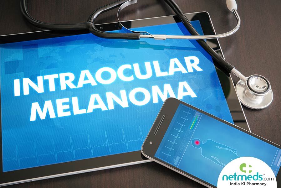 Intraocular Melanoma